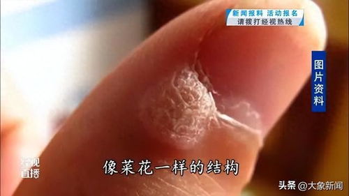 频繁美甲与HPV感染，警示与探讨