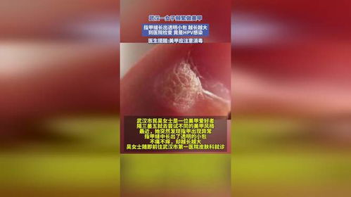 频繁美甲与HPV感染，警示与探讨