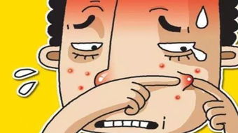 挤破身上痘痘进ICU，警示与反思