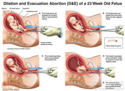 关于7个月引产的全面解读