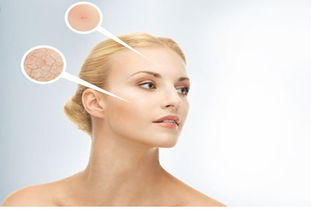 护士用留置针扎耳洞，专业与安全的考量