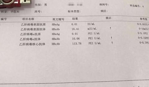 大三阳肝功能正常，了解真相，科学管理健康