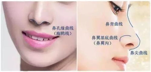 鼻尖整形，塑造完美鼻型的咨询指南