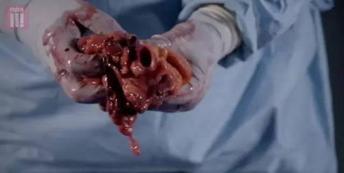 尸体解剖，揭开生命奥秘的科学之旅