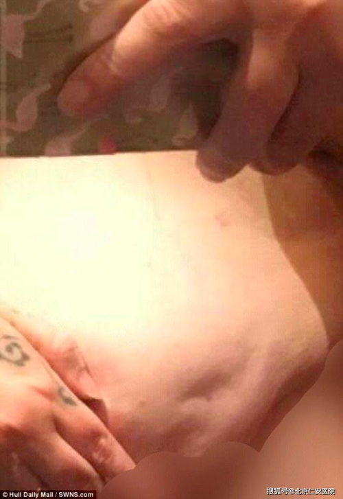 警惕！广东新病毒来袭，我们如何保护自己？