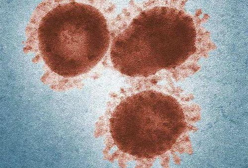 揭秘无症状感染，新冠病毒的隐形威胁